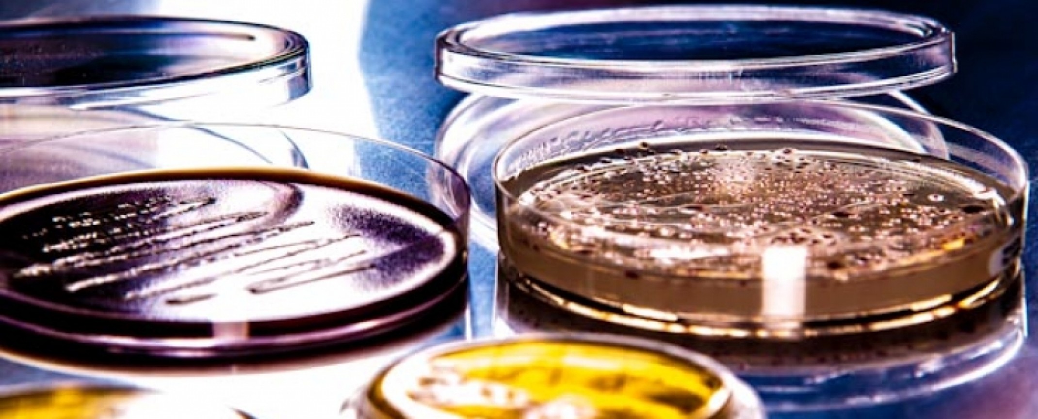 Mikrobiologia przemysłowa